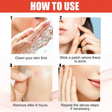 240pcs Star Acne Patches Invisible Pimple Cover for Face Oil Control